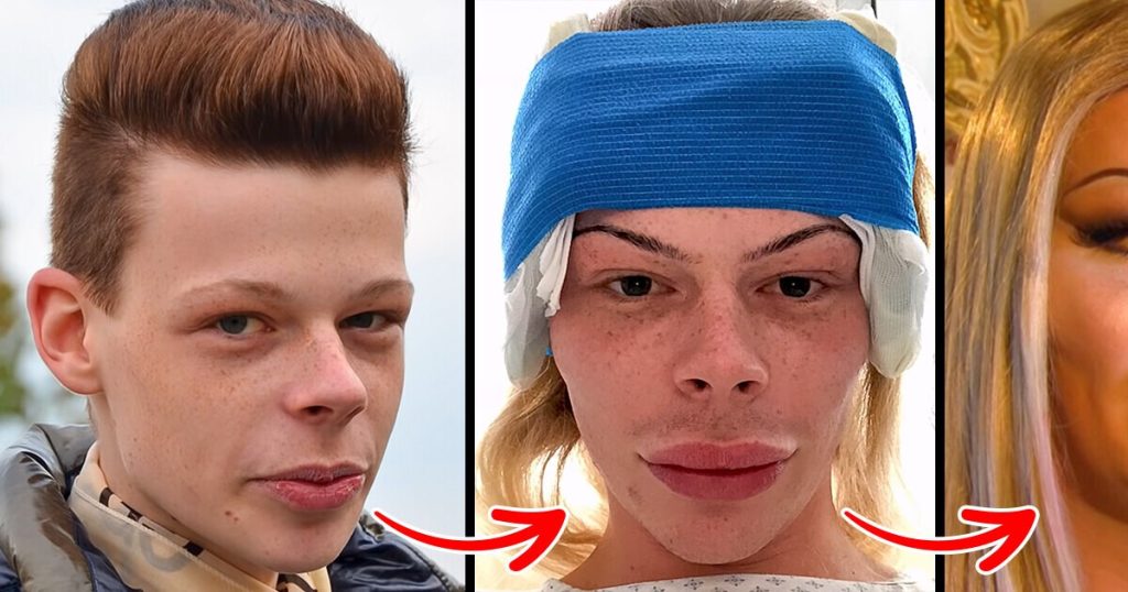 ST13. He paid $73.000 for surgeries to look like a woman…
