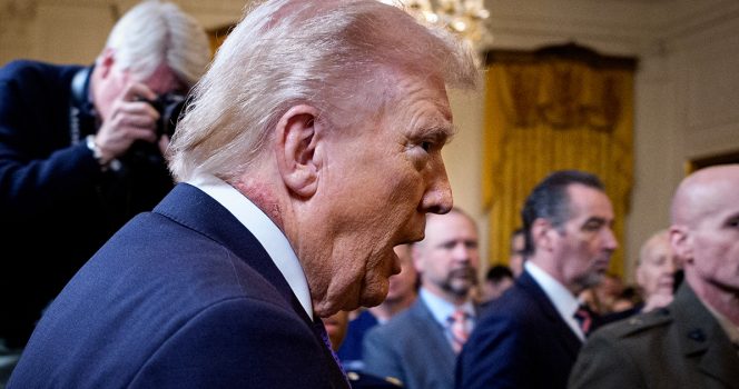 ‘Frank’s Sign’ on Trump’s ear could be huge indicator of potentially fatal health condition
