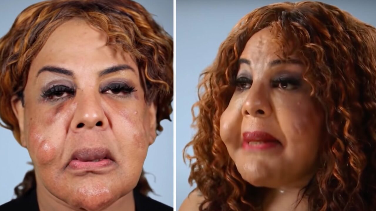 What “Cement Face” lady looks like 21 years later..!