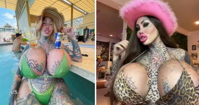 Tragic update on surgery-addicted woman who wanted to become a”forest elf”